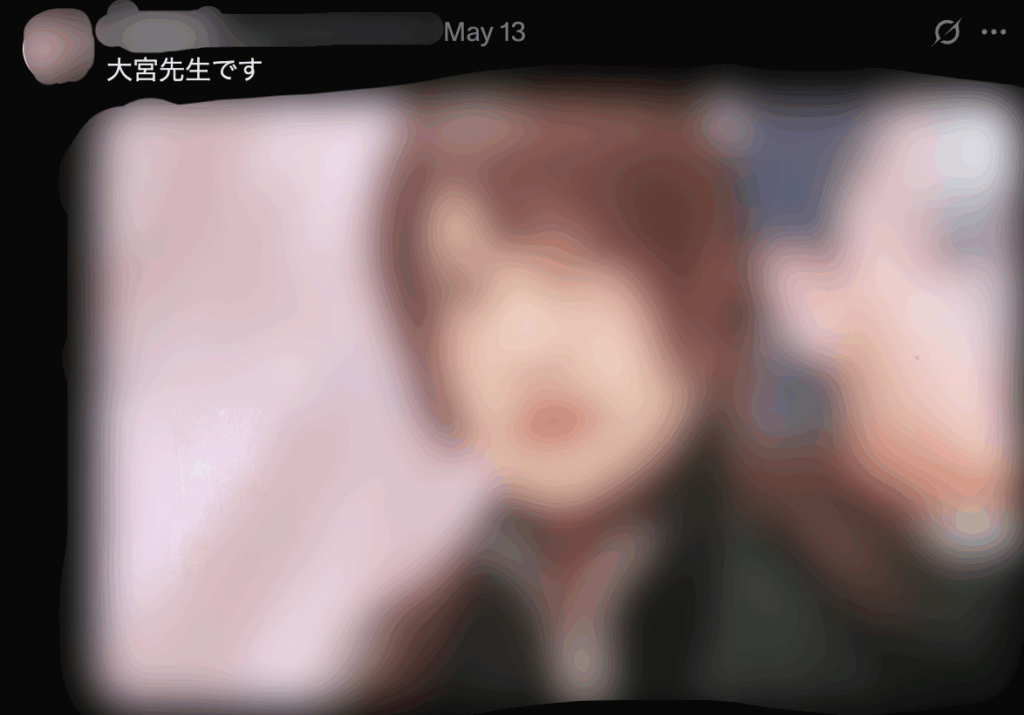 X埋め込み